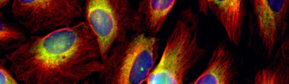 Organelle Marker Antibodies Three color fluorescent cell staining showing nucleus, cytoplasm, and cell membrane.