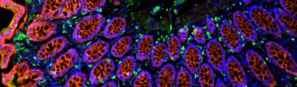 Epitope Tag Antibodies Four color tissue staining by fluorescent immunohistochemistry with cell localization identified via protein target.
