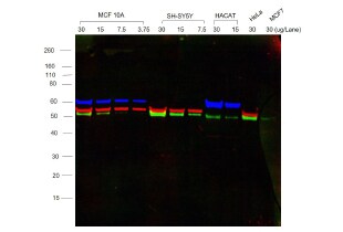 Multiplex western blot Multiplex western blot image showing 3 color staining of 3 protein targets with red, green and blue staining.