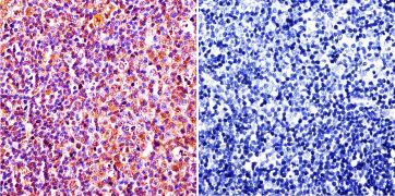 Immunohistochemistry on normal biopsies of deparaffinized rat lymph node tissue. Immunohistochemistry on normal biopsies of deparaffinized rat lymph node tissue.