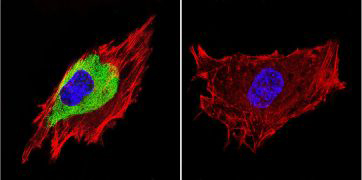 Immunofluorescent analysis of caveolin 3 in C2C11 Cells Immunofluorescent analysis of caveolin 3 in C2C11 Cells