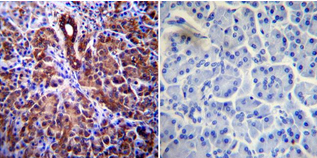 Immunohistochemistry performed on normal biopsies of deparaffinized human pancreas tissue Immunohistochemistry performed on normal biopsies of deparaffinized human pancreas tissue