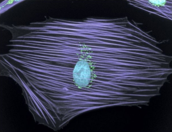Immunofluorescence analysis of Golgi bodies in muntjac skin cells Immunofluorescence analysis of Golgi bodies in muntjac skin cells