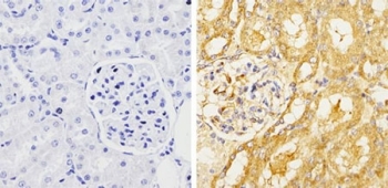 Immunohistochemical analysis of GRASP65 Immunohistochemical analysis of GRASP65