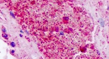 Immunohistochemical analysis of PAR3 Immunohistochemical analysis of PAR3