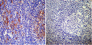 Immunohistochemistry detection of RAB9 on normal deparaffinized human tonsil tissue tissues Immunohistochemistry detection of RAB9 on normal deparaffinized human tonsil tissue tissues