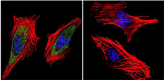 Immunofluorescent analysis of RAB9 Immunofluorescent analysis of RAB9