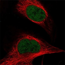 Immunofluorescent analysis of ASH2L Immunofluorescent analysis of ASH2L