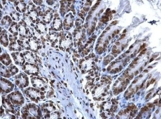 Immunohistochemical analysis of Histone H2A.x Immunohistochemical analysis of Histone H2A.x