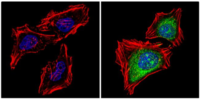 Immunofluorescent analysis of proteasome 20S X using a specific antibody Immunofluorescent analysis of proteasome 20S X using a specific antibody