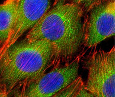 AKT2 staining in C2C12 cells AKT2 staining in C2C12 cells