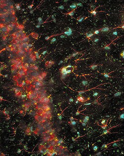 Immunohistochemistry using Invitrogen NMDA Receptor Subunit 2A Polyclonal Antibody Immunohistochemistry using Invitrogen NMDA Receptor Subunit 2A Polyclonal Antibody