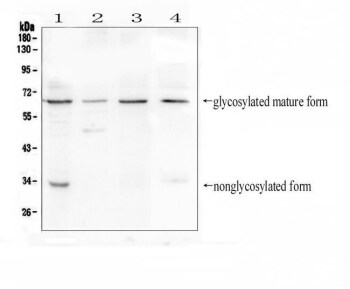 BTLA detection by immunohistochemistry Microscopic image of DAB-stained paraffin-embedded mouse tissue slice showing location of BTLA