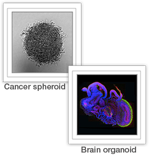 Cancer spheroid and brain organoid Microscopic images of a single spheroid and of a brain organoid