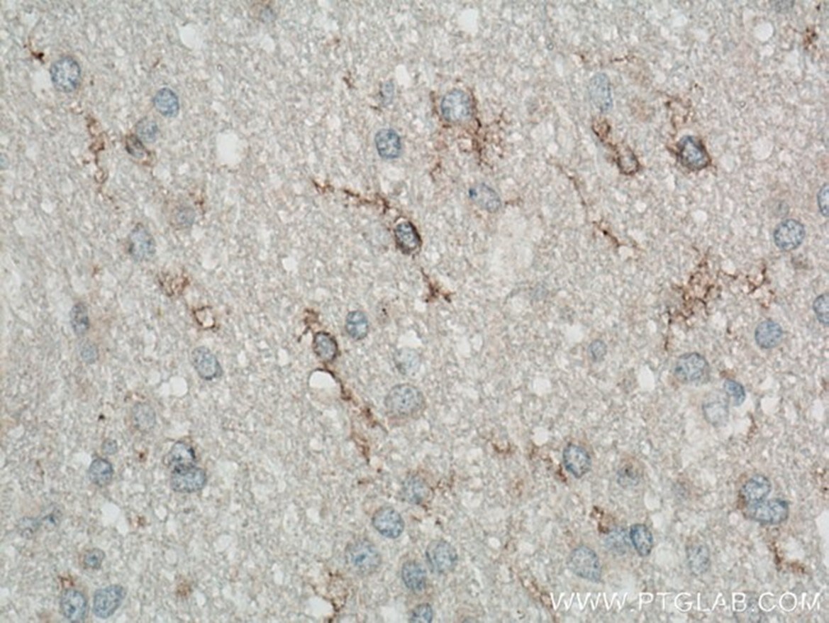 Microglial cells in brain tissue Brain tissue stained with TMEM119 antibody to identify microglial cells. Positive cells are outlined in brown and have cell nucleus stained blue.