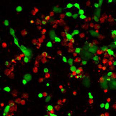 Cytotoxic activity assay of human NK cells Microscope image of the cytotoxicity of human NK cells against K562 cells