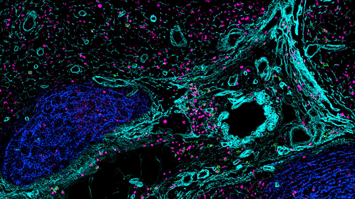 Antibody staining of B cells in the germinal center and medulla of the human lymph node Antibody staining of B cells in the germinal center and medulla of the human lymph node with CD21 (blue), IRF4 (magenta), CD138 (green), a-SMA (turquois)