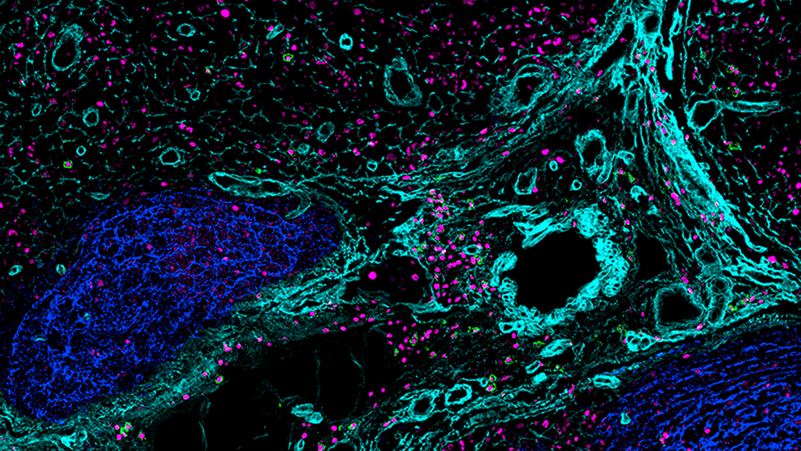 Antibody staining of B cells in the germinal center and medulla of the human lymph node Antibody staining of B cells in the germinal center and medulla of the human lymph node with CD21 (blue), IRF4 (magenta), CD138 (green), a-SMA (turquois)
