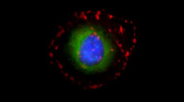 multiplex of HeLa cell structure Microscopic image of HeLa cells stained with red talin, green ER, and blue nucleus
