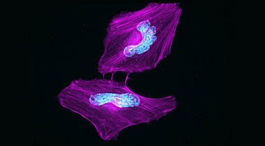 Actin-stained HeLa cells Microscopic image of HeLa cells with red actin and blue nuclei