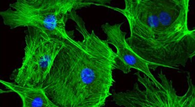 Actin-stained cells Microscopic image of cells with green actin and blue nuclei