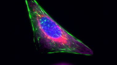 Multiplex of U2OS cell structure Microscopic image of U2OS cells stained with green actin, deep red tubulin, red mitochondria, and blue nucleus
