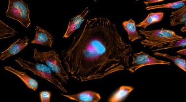 Actin staining of HeLa cells with CellMask Orange Actin Tracking Stain Microscopic image of HeLa cells stained with orange actin, deep red lysosomes, and blue nucleus