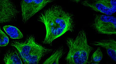Tubulin staining of HeLa cells with Tubulin Tracker Green Microscopic image of HeLa cells stained with green tubulin and blue nucleus