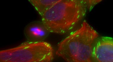 multiplex of HeLa cell structure Microscopic image of HeLa cells stained with green talin, deep red tubulin, and blue nucleus