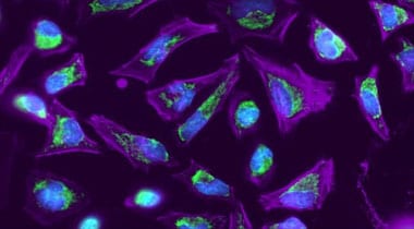 Actin staining of HeLa cells with CellMask Deep Red Actin Tracking Stain Microscopic image of HeLa cells stained with deep red actin, orange mitochondria, and blue nucleus