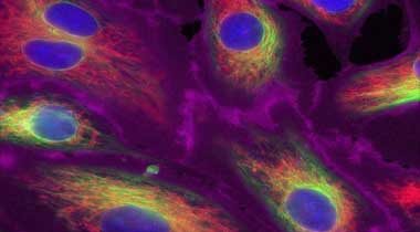 Organelle staining with green ER Microscopic image of cells stained with deep red plasma membrane, green ER, red mitochondria, and blue nucleus