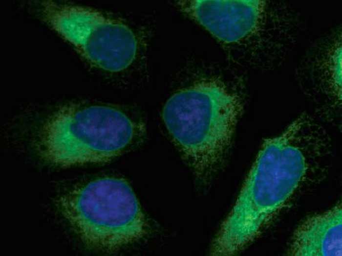 ER GFP staining Microscopic image of cells stained with green ER and blue nucleus