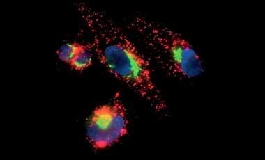 Golgi staining with lysosomes Microscopic image of cells stained with green Golgi, red lysosomes, and blue nucleus