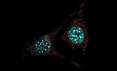 Golgi staining with mitocohondria Microscopic image of cells stained with green Golgi, red mitochondria, blue nuclei