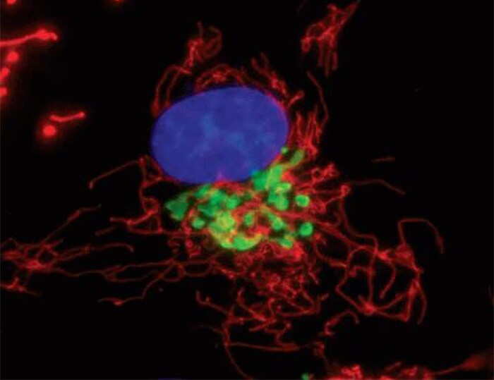 Golgi GFP staining Microscopic image of cells stained with green golgi, red mitochondria, and blue nucleus