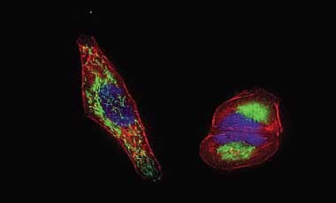 Mitochondrial green staining with CellLight Mitochondria-GFP Microscopic image of cells stained with green mitochondria, red talin, and blue nuclei