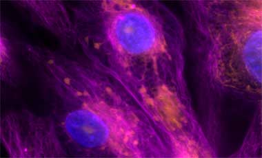 Mitochondrial red staining with Mitotracker Orange Microscopic image of cells stained with orange mitochondria, deep red tubulin, and blue nucleus