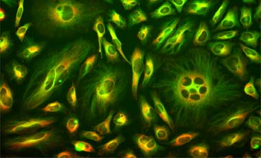 Mitochondria staining with MitoTracker Red Microscopic image of cells stained with red mitochondria and green tubulin