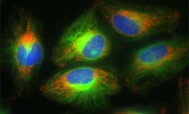 Mitochondrial red staining with CellLight Mitochondria-RFP Microscopic image of cells stained with red mitochondria, green tubulin, and blue nucleus