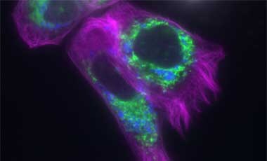 Mitochondrial green staining with MitoTracker Green Microscopic image of cells stained with green mitochondria, blue lysosomes, and deep red tubulin