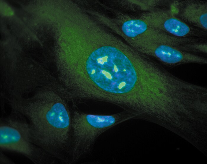 Nucleolus stain Microscopic image of cells stained with green nucleoli and blue nuclei