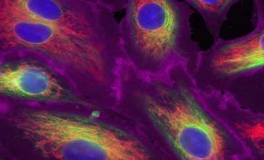 Deep red cell membrane stain Microscopic image of cells stained with magenta plasma membrane, green ER, red mitochondria, and blue nucleus