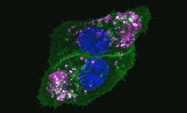 Organelle staining Microscopic image of cells stained with green plasma membrane, deep red cytoplasm, and blue nuclei