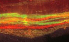 Antero line nerves in brain Nerves labeled with green and red dextran conjugates