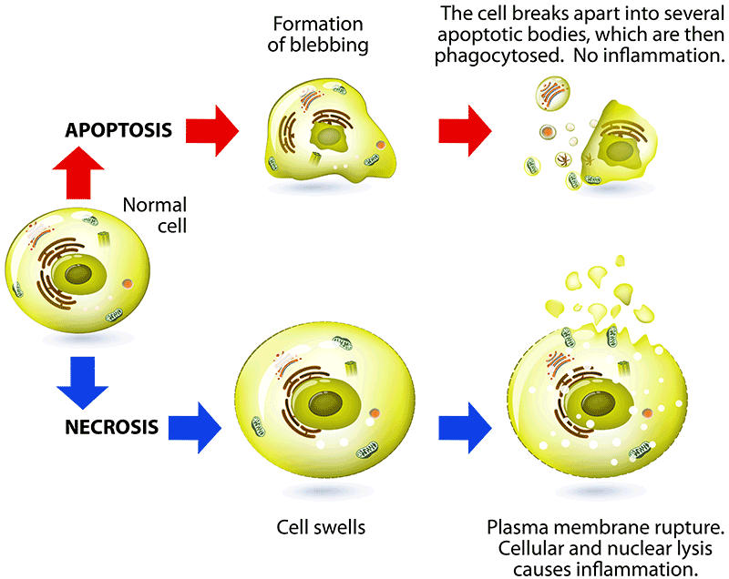 Diagram apoptosis vs necrosis Illustration of the differences in cellular processes of a cell undergoing apoptosis vs necrosis
