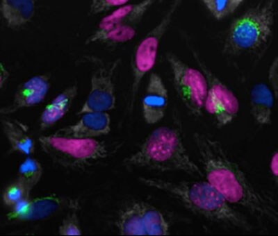 Microscopic image of cell proliferation as indicated by Click-iT Plus EdU Microscopic image of cell proliferation as indicated by Click-iT Plus EdU