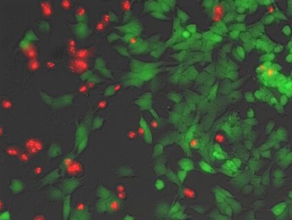LIVE/DEAD Cell Imaging Kit Drug-treated cells showing red dead cells and green live cells