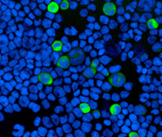 Fluorescence imaging Fluorescence imaging