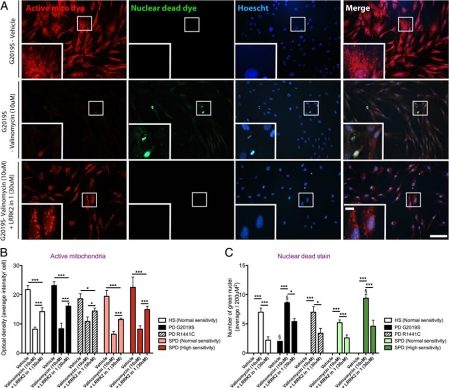 Cells stained with MitoTracker Red and imaged with Incucyte® ZOOM Live-Cell Analysis Cells stained with MitoTracker Red as indicated with cells with active mitochondria being bright red, the dead cells are stained in green, the nucleus in blue, and imaged with Incucyte® ZOOM Live-Cell Analysis