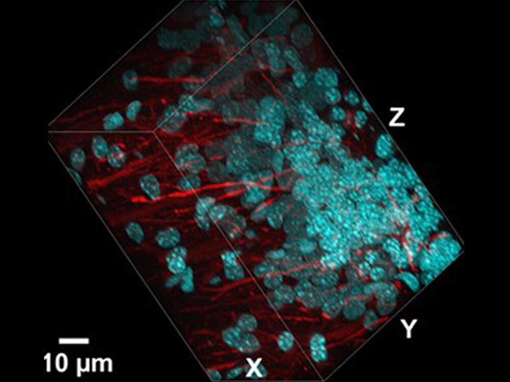 prolong glass antifade 100-µm thick cryo preserved rat brain section fluorescently labeled and mounted with prolong glass antifade